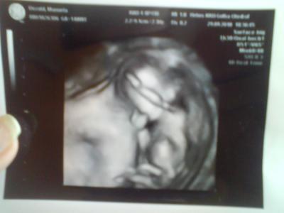 Bild zu 3D bild wie versprochen - Forum für März - Mamis