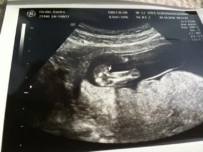 Bild zu Heute VU und ein 95%iges Outing - Forum für März - Mamis