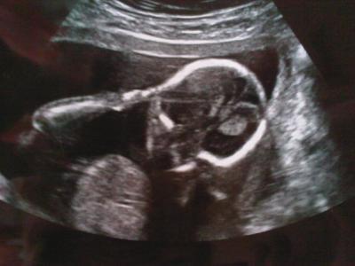 Bild zu mein süsser bauchzwerg :-) - Forum für März - Mamis