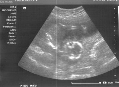 Bild zu Hab gestern auch wieder meinen kleinen Schatz bewundern können... - Forum für März - Mamis