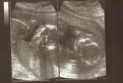 Bild zu Meine beiden ... - Forum für März - Mamis