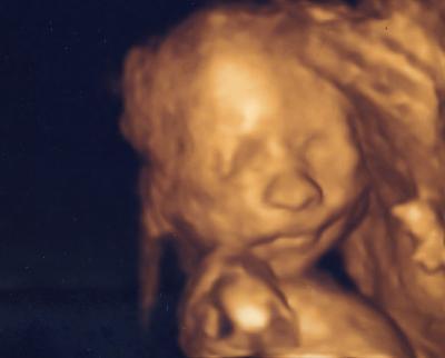 Bild zu grosses Organscreening und Outing - Forum für März - Mamis