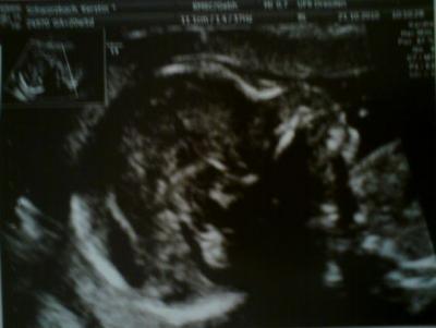 Bild zu Bildchen-Nachtrag :) - Forum für März - Mamis