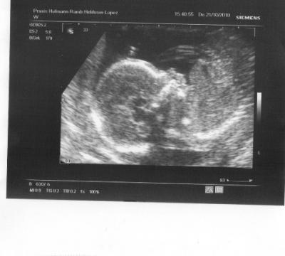 Bild zu Zurück von der VU mit einem Outing!!! :-)) - Forum für März - Mamis