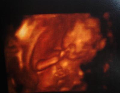 Bild zu Zurück vom FA mit 4D Bild - Forum für März - Mamis