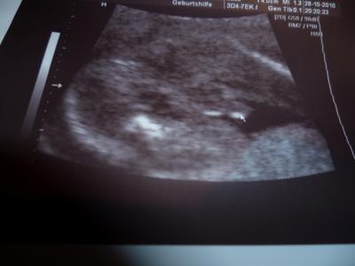 Bild zu zurück vom FA und n bissel traurig - Forum für März - Mamis