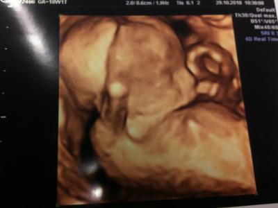 Bild zu FA-Termin am Freitag :-) - Forum für März - Mamis