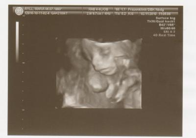 Bild zu sind zurück vom Klinikum, Feinsono war ganz toll :-) - Forum für März - Mamis