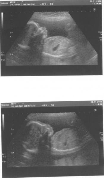 Bild zu Zurück vom FA... mit Profilbildchen! - Forum für März - Mamis