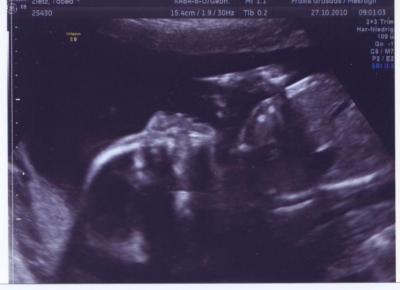 Bild zu Ich hab auch noch ein Foto - Forum für März - Mamis