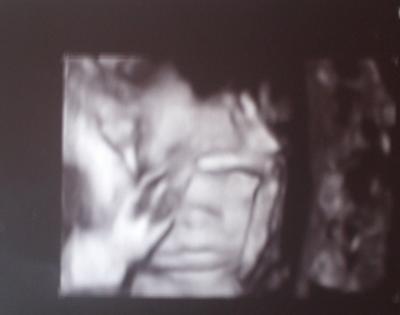 Bild zu Mich mal melden + VU Bericht - Forum für März - Mamis