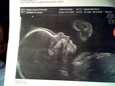 Bild zu Gestern Pränataldiagnostik - Forum für März - Mamis