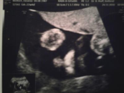 Bild zu noch ein paar fotos ;-) - Forum für März - Mamis