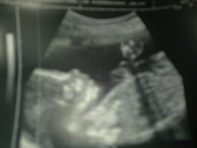 Bild zu Mal zeigen will :) - Forum für März - Mamis