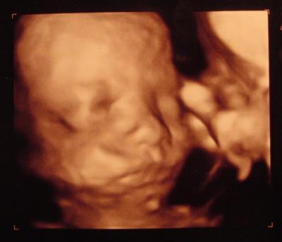 Bild zu 3d-Bild vom Zwerg - Forum für März - Mamis