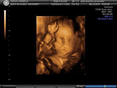 Bild zu Hier endlich auch mal ein Bildchen vom meinem Wurm.. - Forum für März - Mamis