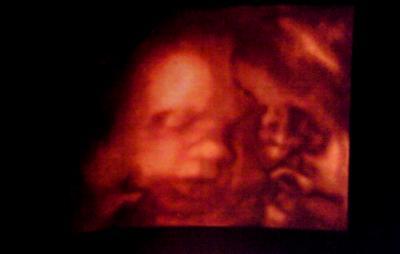 Bild zu FA Termin :) - Forum für März - Mamis