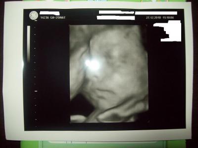 Bild zu Euch mal Leandro vorstellen mag :o) - Forum für März - Mamis