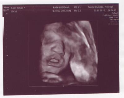 Bild zu Ein Bildchen... - Forum für März - Mamis