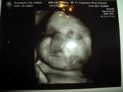 Bild zu War heut beim FA und wollte euch mal meine BauchMaus zeigen - Forum für März - Mamis