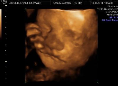 Bild zu Möchte jemand vorstellen! - Forum für März - Mamis