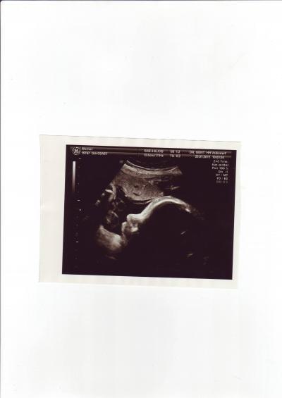 Bild zu Mein Bauchbewohner - Forum für März - Mamis