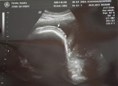 Bild zu Und mal ein Bildchen von der Haarpracht unser Kleinen - Forum für März - Mamis