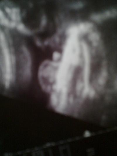 Bild zu So, wieder da :-) - Forum für März - Mamis