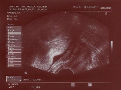 Bild zu Popobild - Forum für März - Mamis