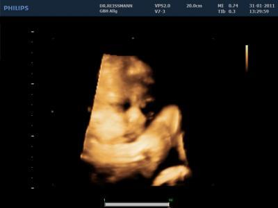 Bild zu Heute ET aber nix in Sicht das der Herr kommen will... - Forum für März - Mamis