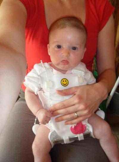Bild zu meine maus hat die tübinger hüftschiene :-( noch ein baby mit hüftproblem??? - Forum für März - Mamis