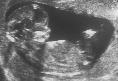 Bild zu Kennt ihr mich noch? - Forum für März - Mamis