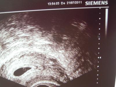 Bild zu Bin zurück. Krankenhausbericht! - Forum für März - Mamis