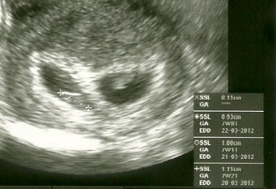 Bild zu Zurück vom FA :-) - Forum für März - Mamis