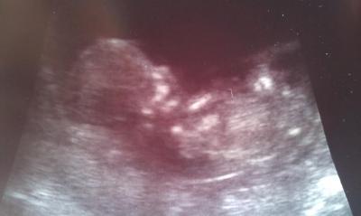 Bild zu Baby Foto :) - Forum für März - Mamis