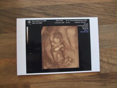 Bild zu heute 13. SSW und super FA-Termin *freu freu freu* - Forum für März - Mamis