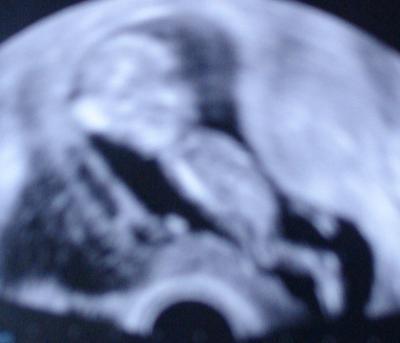 Bild zu Junior - Foto - Forum für März - Mamis