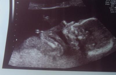 Bild zu US Bild von gestern :) - Forum für März - Mamis