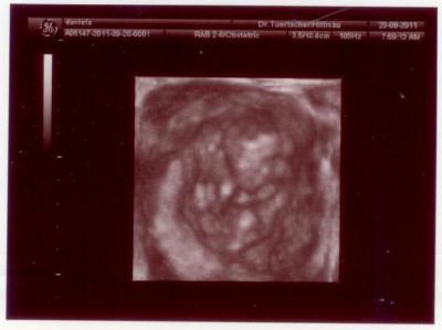 Bild zu Nachtrag zu: alles in Ordnung mit dem Würmchen (Fotos) - Forum für März - Mamis