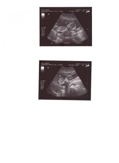 Bild zu Neues Ultraschallbild von unserem Krümel! - Forum für März - Mamis