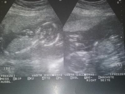 Bild zu zurück vom FA mit neuem Foto :-) - Forum für März - Mamis