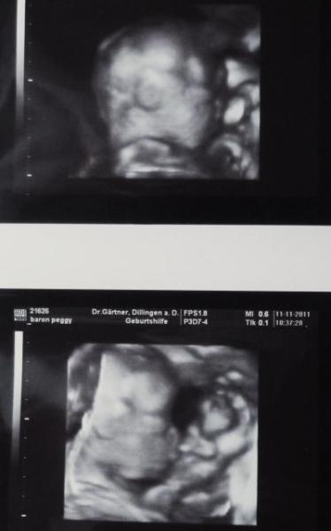 Bild zu baby-bilder :) - Forum für März - Mamis