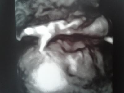 Bild zu Neuste Bild von meiner kleinen Maus - Forum für März - Mamis