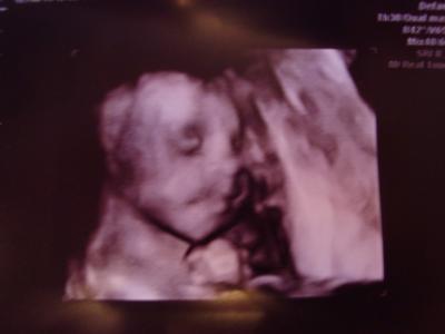 Bild zu Wieder zurück von der Doppler Untersuchung... +Bilder - Forum für März - Mamis