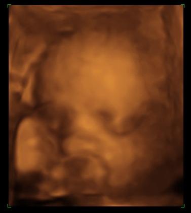 Bild zu In die 31. SSW gekugelt und der kleine Schlingel hat sich gedreht - Forum für März - Mamis