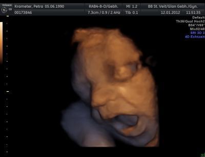 Bild zu 3D-Screeing - - Forum für März - Mamis