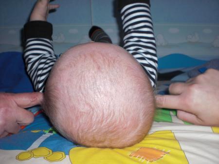 Bild zu 