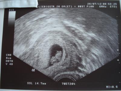 Bild zu Gummibärchen und ich zurück vom FA - Forum für März - Mamis
