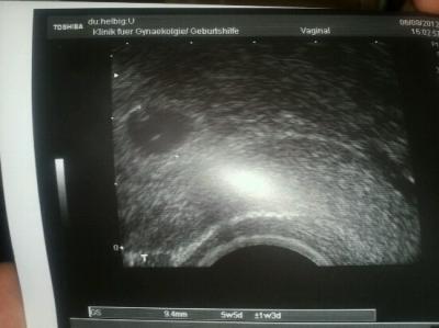 Bild zu Hallöchen habe heute was positives ;) - Forum für März - Mamis