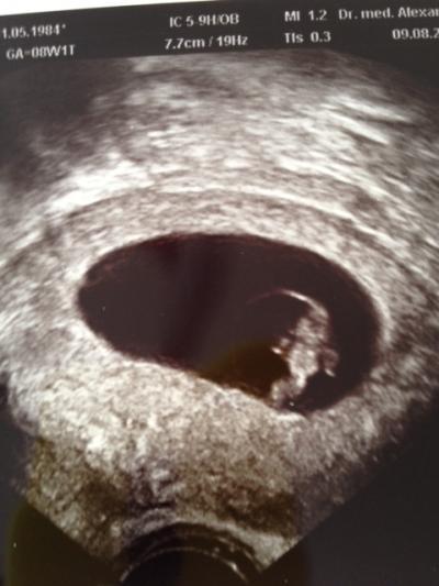 Bild zu Zurück vom FA (wegen Durchfall) + Foto - Forum für März - Mamis